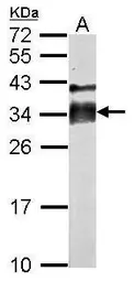 Anti-Acrosomal vesicle protein antibody used in Western Blot (WB). GTX114236