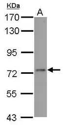 Anti-ADAR2 antibody used in Western Blot (WB). GTX114237