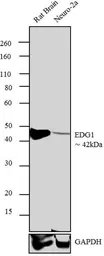 Anti-EDG1 antibody used in Western Blot (WB). GTX11424