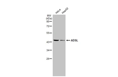 Anti-ADSL antibody [N3C3] used in Western Blot (WB). GTX114243