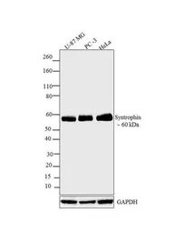 Anti-SNTB2 antibody [1351] used in Western Blot (WB). GTX11425