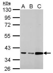 Anti-Annexin III antibody used in Western Blot (WB). GTX114253