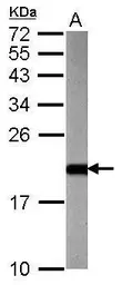 Anti-ARF3 antibody used in Western Blot (WB). GTX114260