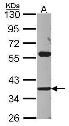 Anti-ART3 antibody [N3C3] used in Western Blot (WB). GTX114266