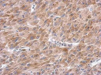 Anti-Asparagine synthetase antibody used in IHC (Paraffin sections) (IHC-P). GTX114269