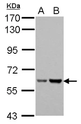 Anti-Asparagine synthetase antibody used in Western Blot (WB). GTX114269