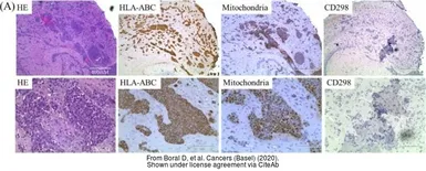 Anti-Sodium/Potassium ATPase beta 3 antibody [N2C3] used in Immunohistochemistry (IHC). GTX114272