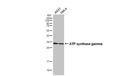 Anti-ATP synthase gamma antibody used in Western Blot (WB). GTX114275