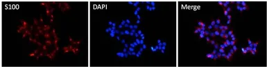Anti-S100 alpha antibody used in Immunocytochemistry/ Immunofluorescence (ICC/IF). GTX11428