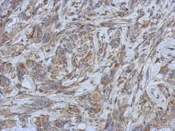 Anti-Filensin antibody [N1C1] used in IHC (Paraffin sections) (IHC-P). GTX114282