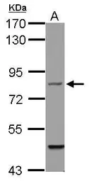 Anti-Filensin antibody [N1C1] used in Western Blot (WB). GTX114282