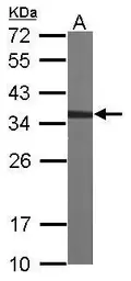 Anti-CAPZA2 antibody [N2C3] used in Western Blot (WB). GTX114303