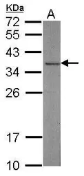 Anti-CAPZA2 antibody [N2C3] used in Western Blot (WB). GTX114303
