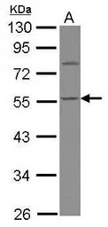 Anti-Calsequestrin 1 antibody used in Western Blot (WB). GTX114304