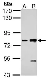 Anti-K-Cadherin antibody [N3C2], Internal used in Western Blot (WB). GTX114313