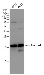 Anti-Centrin 1 antibody [N1C3] used in Western Blot (WB). GTX114316