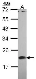 Anti-Centrin 1 antibody [N1C3] used in Western Blot (WB). GTX114316