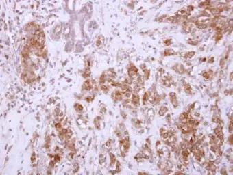 Anti-CHAD antibody used in IHC (Paraffin sections) (IHC-P). GTX114318