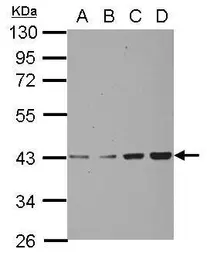 Anti-CHAD antibody used in Western Blot (WB). GTX114318