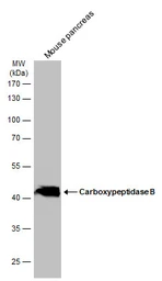 Anti-Carboxypeptidase B antibody [N3C3] used in Western Blot (WB). GTX114334