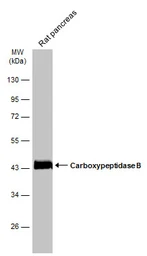 Anti-Carboxypeptidase B antibody [N3C3] used in Western Blot (WB). GTX114334