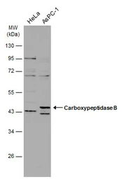 Anti-Carboxypeptidase B antibody [N3C3] used in Western Blot (WB). GTX114334