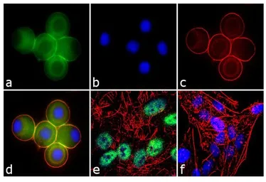 Anti-Ataxin 7 antibody used in Immunocytochemistry/ Immunofluorescence (ICC/IF). GTX11434