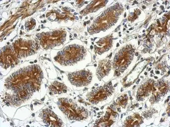 Anti-CSH2 antibody used in IHC (Paraffin sections) (IHC-P). GTX114343