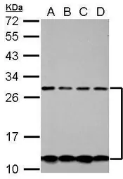 Anti-CSH2 antibody used in Western Blot (WB). GTX114343