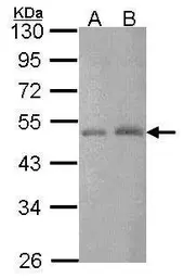 Anti-CtBP2 antibody [N1N3] used in Western Blot (WB). GTX114346