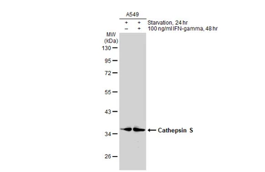 Anti-Cathepsin S antibody used in Western Blot (WB). GTX114350