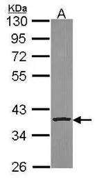 Anti-Cathepsin S antibody used in Western Blot (WB). GTX114350