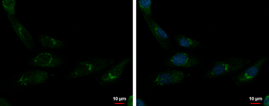 Anti-CUTL1 antibody used in Immunocytochemistry/ Immunofluorescence (ICC/IF). GTX114351