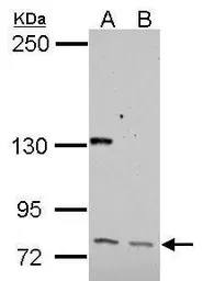 Anti-CUTL1 antibody used in Western Blot (WB). GTX114351