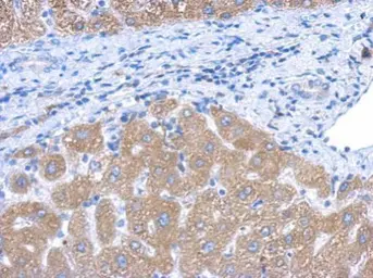 Anti-CYP4A11 antibody [N3C3] used in IHC (Paraffin sections) (IHC-P). GTX114353
