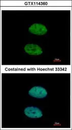 Anti-DDX3 antibody used in Immunocytochemistry/ Immunofluorescence (ICC/IF). GTX114360