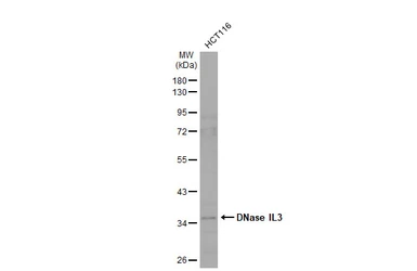 Anti-DNase IL3 antibody [N3C3] used in Western Blot (WB). GTX114363