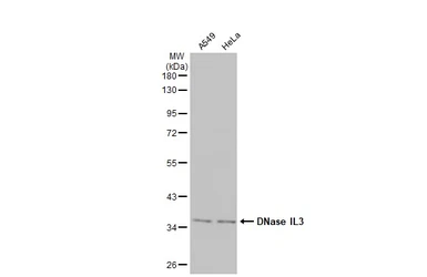 Anti-DNase IL3 antibody [N3C3] used in Western Blot (WB). GTX114363