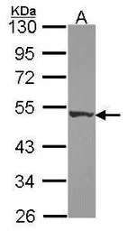 Anti-DPH2 antibody used in Western Blot (WB). GTX114366