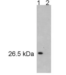 Anti-PSMA5 antibody used in Western Blot (WB). GTX11437