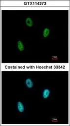 Anti-E2F6 antibody used in Immunocytochemistry/ Immunofluorescence (ICC/IF). GTX114373