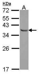 Anti-E2F6 antibody used in Western Blot (WB). GTX114373