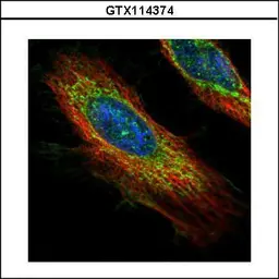 Anti-ECH1 antibody used in Immunocytochemistry/ Immunofluorescence (ICC/IF). GTX114374