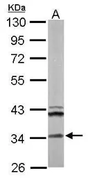 Anti-ECH1 antibody used in Western Blot (WB). GTX114374