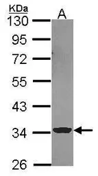 Anti-ECH1 antibody used in Western Blot (WB). GTX114374