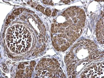 Anti-ECHS1 antibody [N1C2] used in IHC (Paraffin sections) (IHC-P). GTX114376