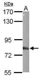 Anti-EML1 antibody [N1N3] used in Western Blot (WB). GTX114381