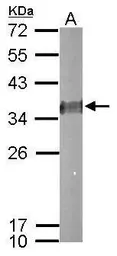 Anti-ESD antibody used in Western Blot (WB). GTX114391