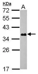Anti-ESD antibody used in Western Blot (WB). GTX114391