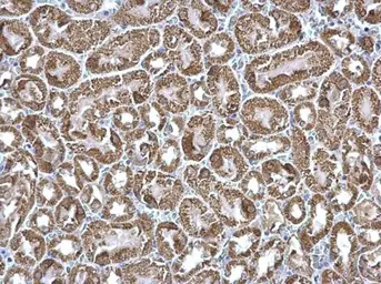 Anti-ETFA antibody used in IHC (Paraffin sections) (IHC-P). GTX114392